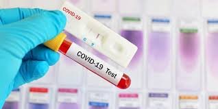 Seluruh Imam Masjid Paripurna Jalani Rapid Test Massal.