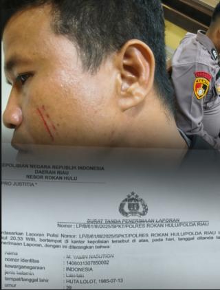 Bermula dari Serempetan Berujung Penganiayaan Oknum Polisi Rokan Hulu Laporkan Pelaku ke Polisi